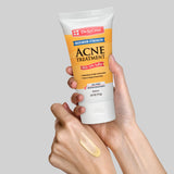 De La Cruz Acne Treatment